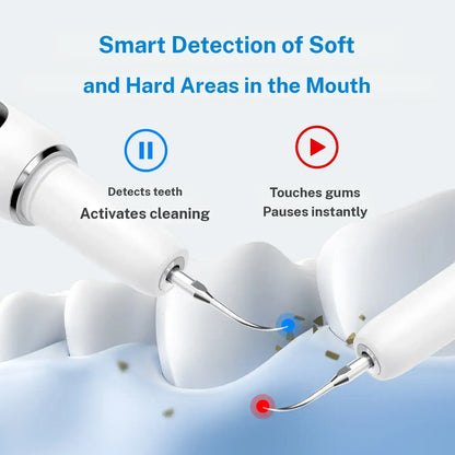 UItrasonic Dental Plaque andTartar Remover,Professional Teeth CleaningKit for Tartar & Stains Removal, Safe & GentleElectric Teeth Cleaning Tools PreventingCavities Bad Breath and Gum Disease for At-Home Oral Care Solution