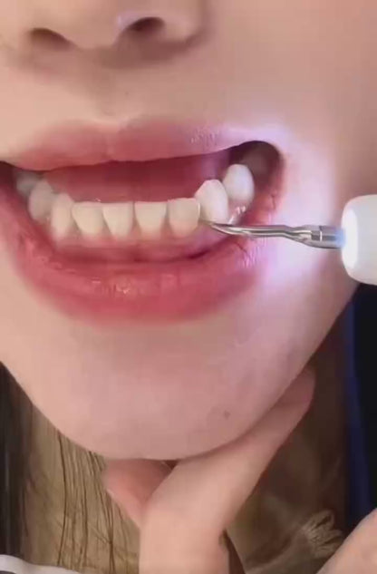 UItrasonic Dental Plaque andTartar Remover,Professional Teeth CleaningKit for Tartar & Stains Removal, Safe & GentleElectric Teeth Cleaning Tools PreventingCavities Bad Breath and Gum Disease for At-Home Oral Care Solution
